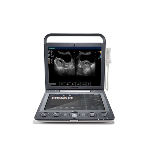 S9 - Échographe portable couleur SonoScape