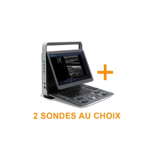 E1 - Portable Noir et Blanc SonoScape